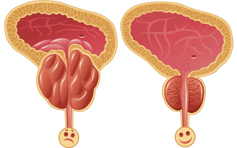 causes of potential problems in men